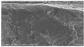 圖11-154 斷面A1、A2區(qū)邊沿微觀形貌